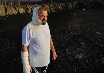 Un vecino de Cipérez herido en el incendio: «El fuego corría más que yo»