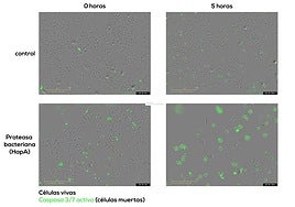 El CIC lidera la investigación que revela un mecanismo bacteriano que destruye células tumorales