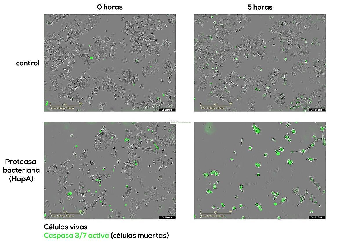 El CIC lidera la investigación que revela un mecanismo bacteriano que destruye células tumorales