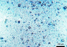 10–30 Mikrometer kleine Kunststoffkügelchen aus Polyethylen in einer Zahnpasta.