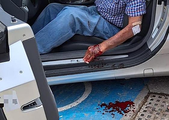 The man's bloodied hand after the horrific ordeal.