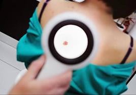 A dermatology team and a consultant from the UK will be holding a clinic.