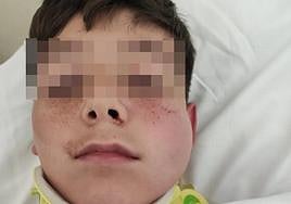 Íker, receiving treatment at the Costa del Sol Hospital, shortly after the alleged attack.