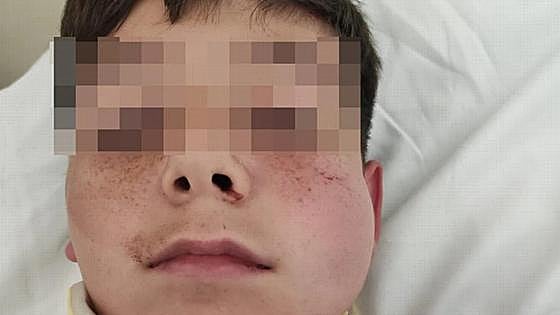 The shocking moment a man knocked a 12-year-old boy unconscious on the Costa del Sol, because the noise of a football bothered him