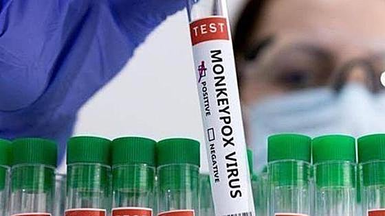 Three cases of monkeypox confirmed in Andalucía, including a six-year-old boy