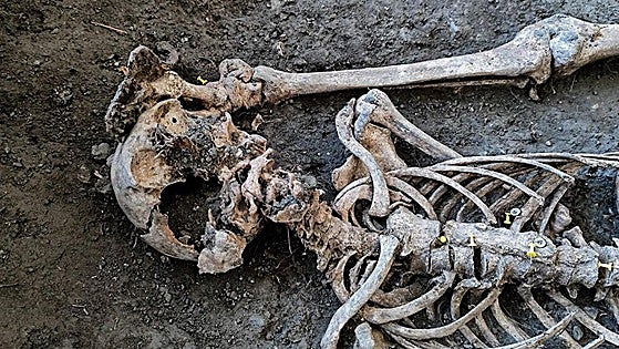 Thieves desecrate war grave to take gold teeth from skeleton in Spain