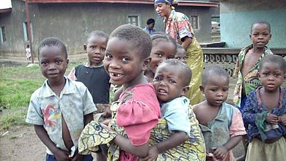 Call-out for families in Andalucía to host African children undergoing serious medical treatment