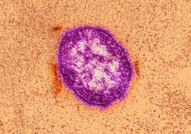 Microscopic image of measles virus.