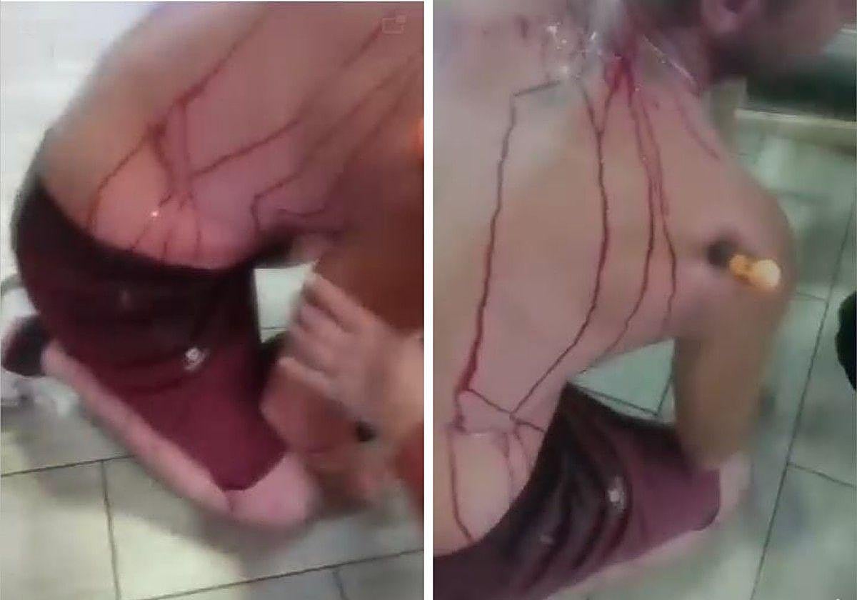 Stabbing in Mijas: man rushed to hospital with screwdriver in shoulder