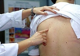 A doctor points to a mole on a patient's back.