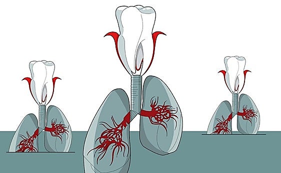 Take care of your gums and you'll take care of your lungs