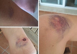 Mother and daughter beaten in traffic dispute in Benalmádena