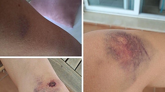 Mother and daughter beaten in traffic dispute in Benalmádena