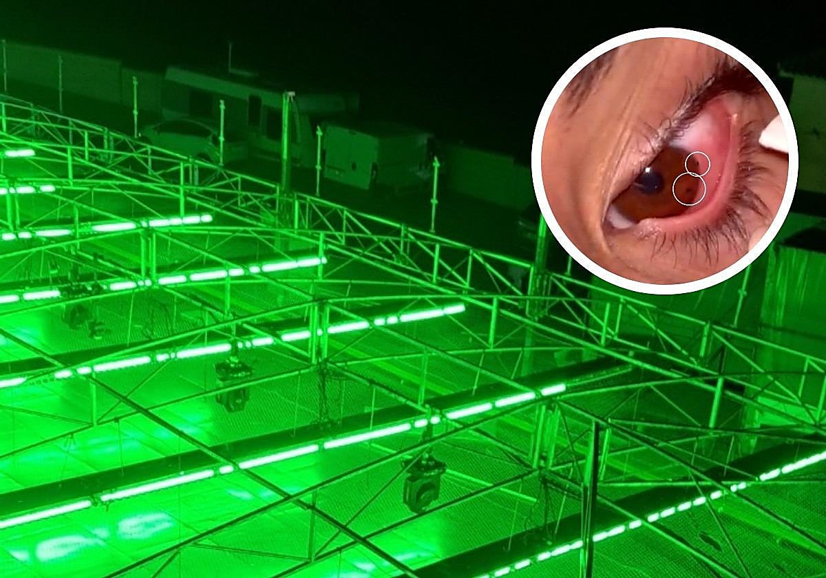 'They have metal in their eyes,' say parents of youngsters injured by bumper car attraction at Valle de Abdalajís fair