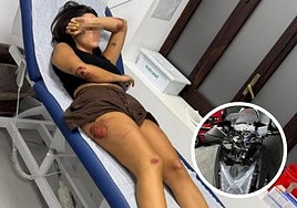 The young woman with her injuries and the damage to her motorbike after the accident.