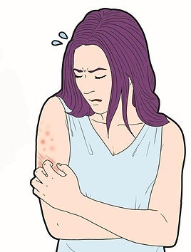 Chronic urticaria: how to live with hives and itching on a daily basis