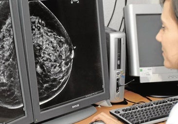 Andalusian health service to contact 2,000 women with inconclusive breast cancer screening results