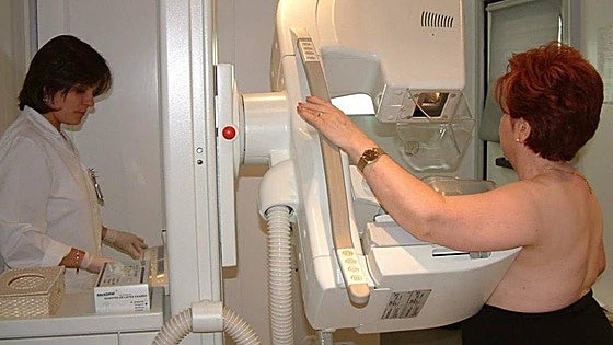 Breast cancer rates have increased by 22% in a decade in Malaga, but survival rates are now 90%