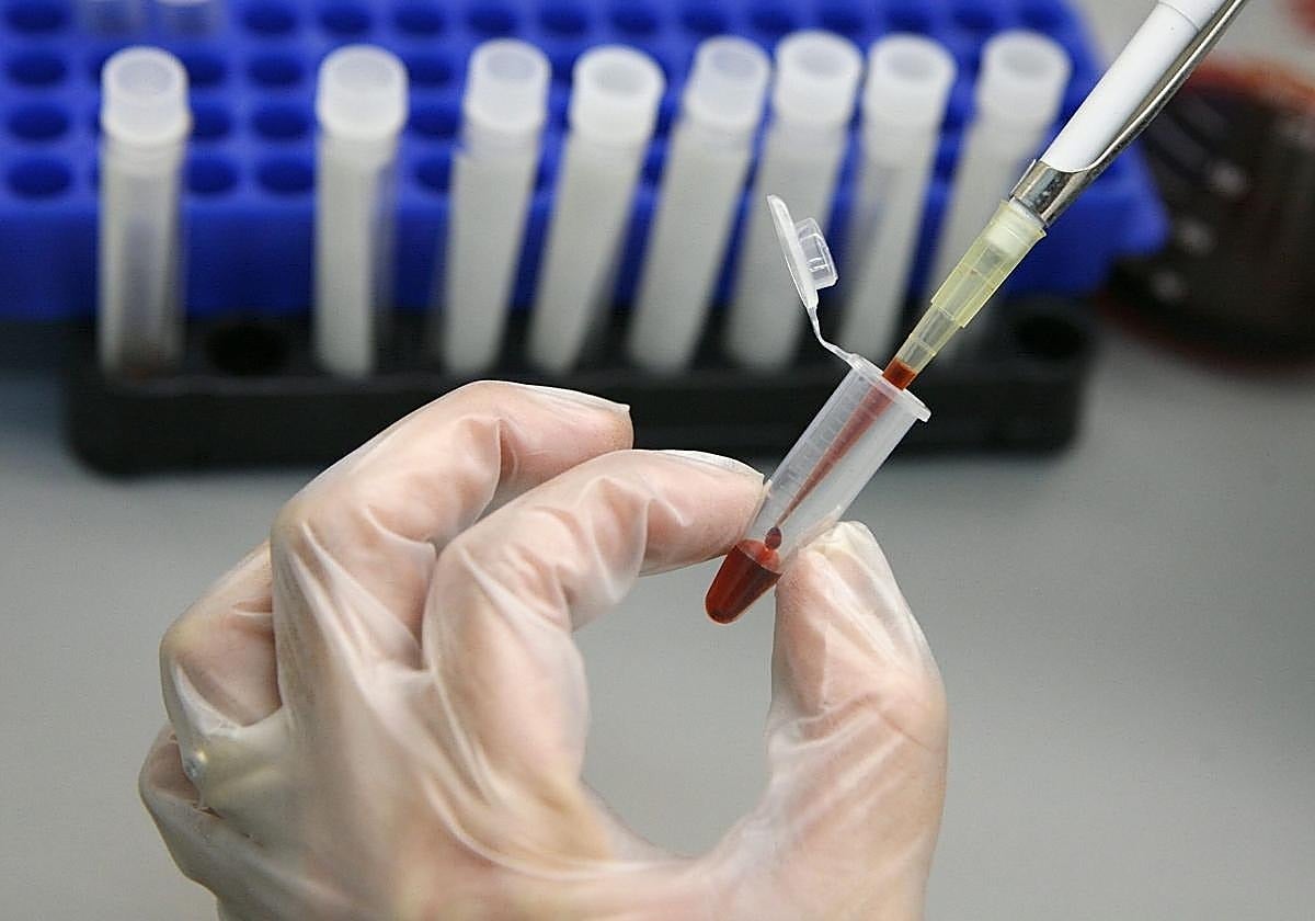 A lab technician tests a blood sample for HIV infection.