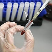 A healthcare worker handles a blood sample in a pathology lab.
