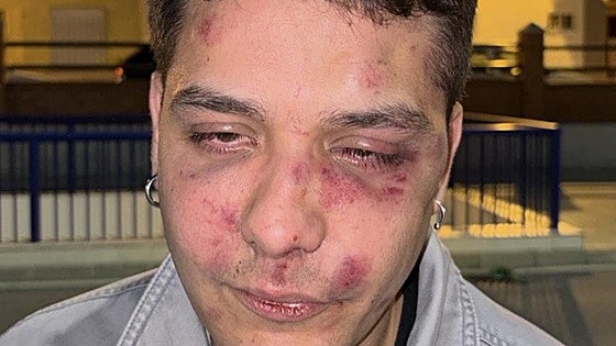 Malaga nightclub assault: young man brutally beaten in 'antifascist' attack