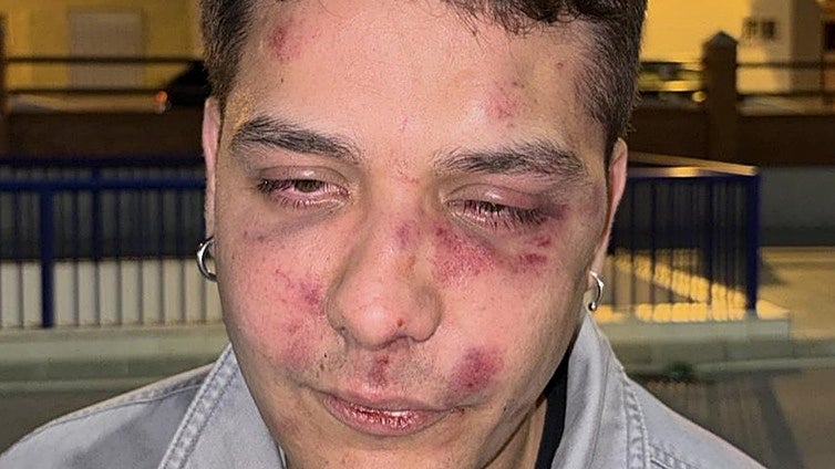 Malaga nightclub assault: young man brutally beaten in 'antifascist' attack