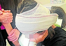 The student received up to 15 stitches to reconstruct the tear in the affected ear.