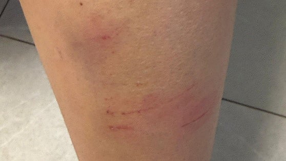 Malaga student reports continuous bullying after getting beaten up by classmates