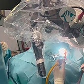 Doctors performing a cochlear implant surgery.