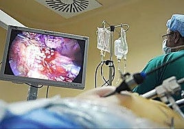 Photo from a colonoscopy.