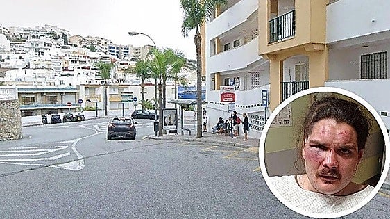 Two arrested following brutal attack of young man in La Herradura