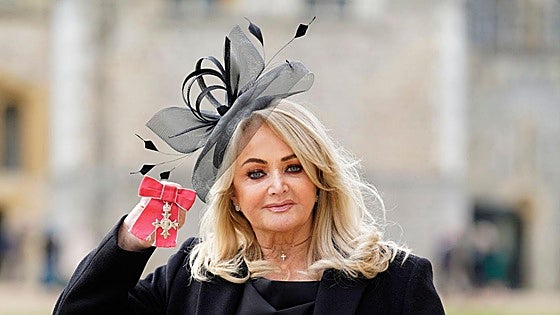 UPDATE: Bonnie Tyler in induced coma after appendix bursts in Portugal