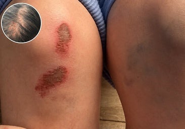 Ana's injuries