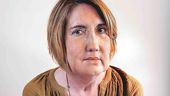 Carmen’s life after a face transplant: ‘I recognise myself by my eyes’