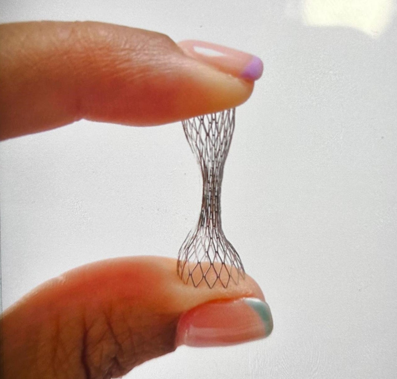 El implante lleva por nombre 'Reducer'.