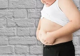 Un niño con obesidad.