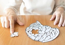Representación en relación al Alzheimer.