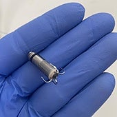 El Hospital General Universitario de Elche implanta por primera vez un marcapasos sin cables