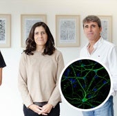 Neurociencia UMH ofrece una nueva perspectiva de cómo actúa el Alzheimer