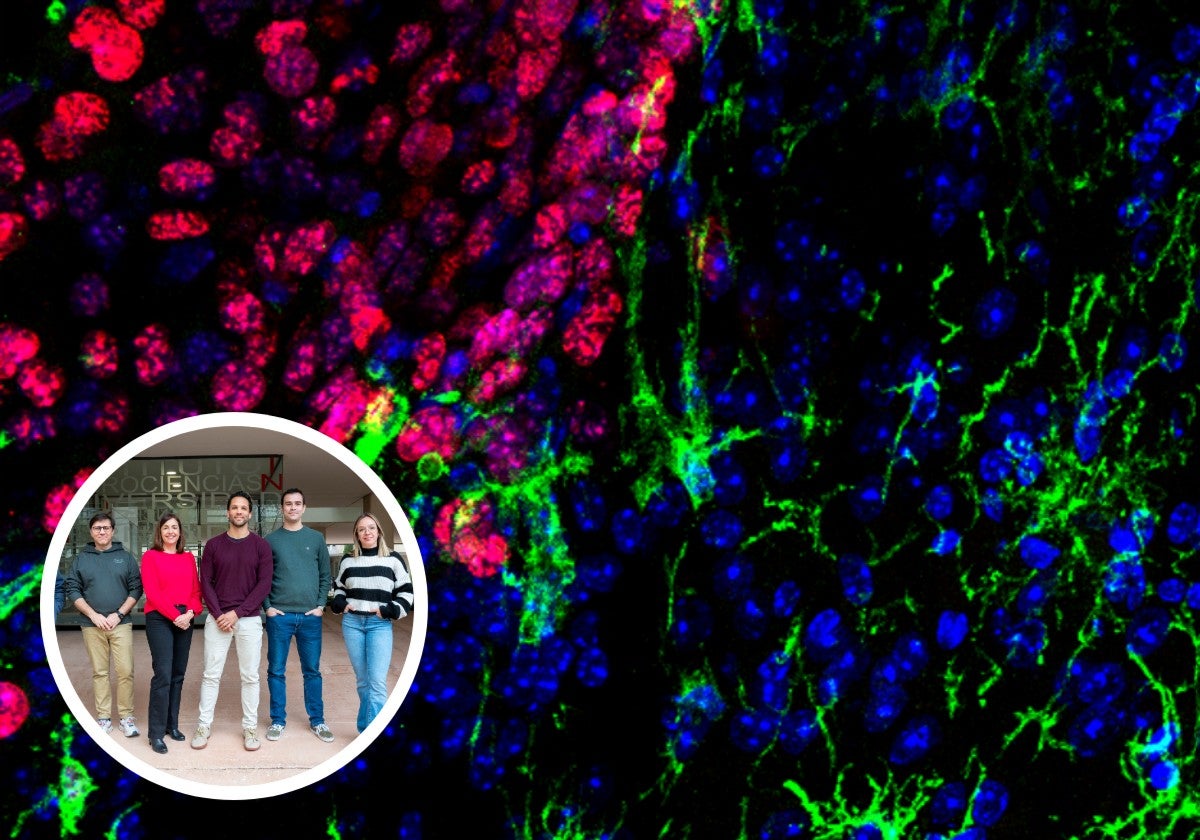 Descubren Alicante una nueva estrategia para combatir las metástasis cerebrales de melanoma