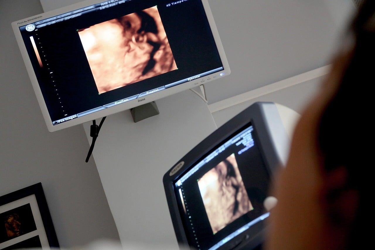El retraso en la edad materna plantea nuevos desafíos médicos.