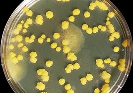 El estudio se ha centrado en el hongo Mucor circinelloides, un patógeno que puede causar infecciones muy graves en personas inmunocomprometidas.