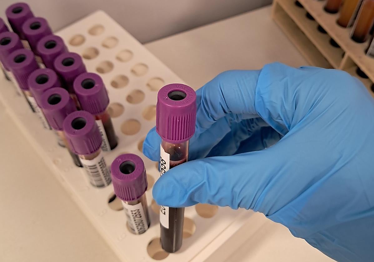 Durante el 2024 se registraron 840 nuevos donantes de médula ósea en la provincia de Alicante.