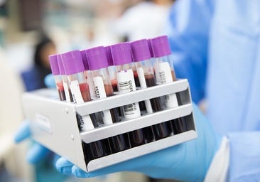 Investigadores de la UMH abren la puerta al diagnóstico temprano del Parkinson mediante análisis de sangre