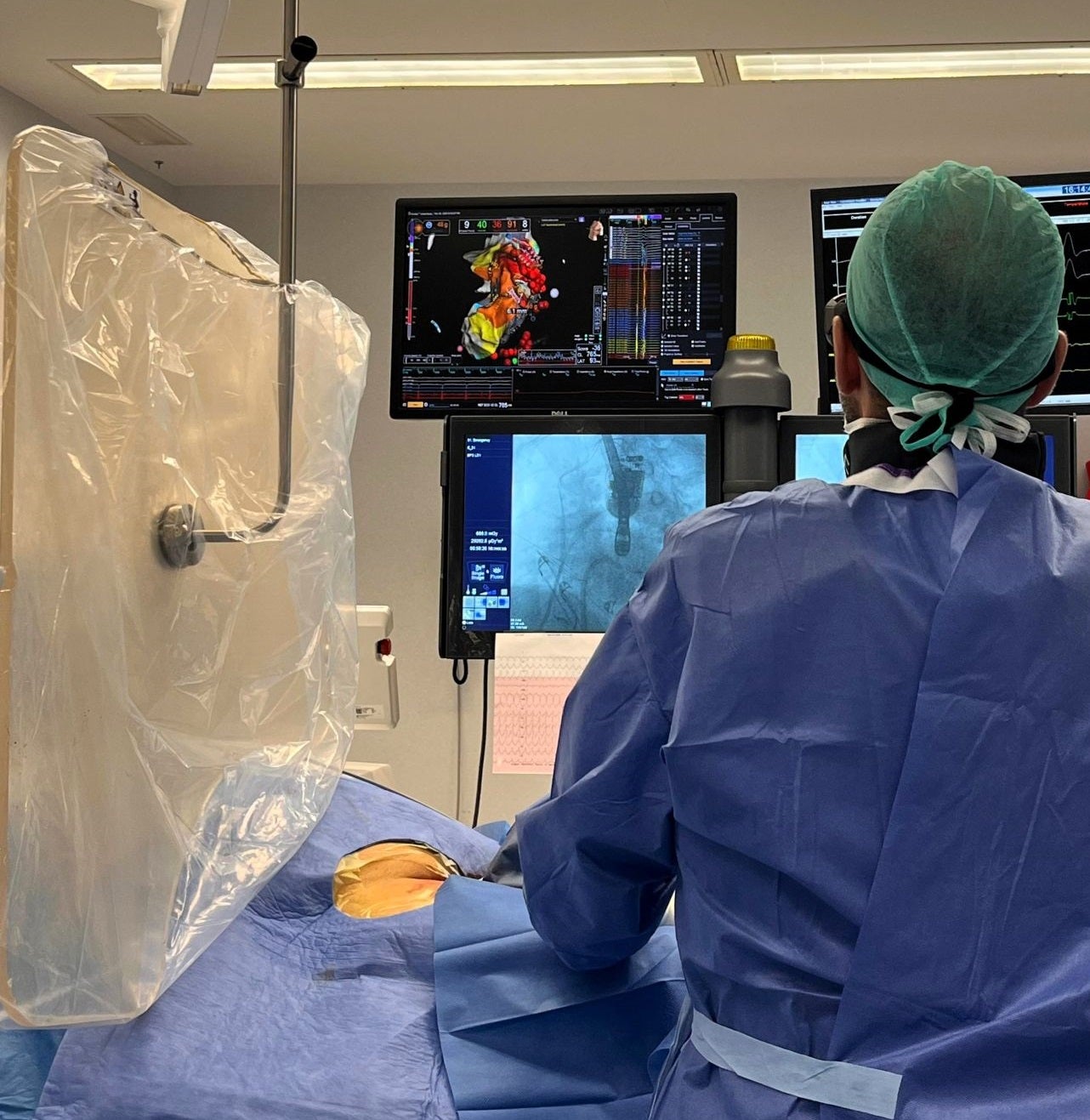 La técnica reduce el riesgo de complicaciones asociadas al acceso percutáneo epicárdico.